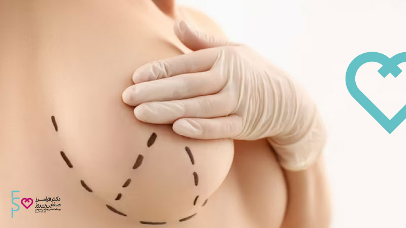 جراحی سینه | عوارض پروتز سینه
